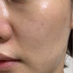 백날천날 화장품 좋은거 써도 똑같은 이유
