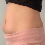 [19] 다이어트 1등템 믿지마라