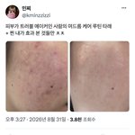 <b>피부</b>가 트러블 메이커인 사람의 여드름 케어 루틴