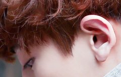 부어도 귀여운 찬열이