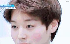 홍조있는거 귀여워