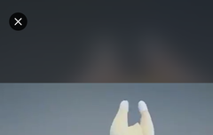 영재 닭다리ㅋㅋㅋㅋㅋㅋㅋ