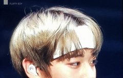 박지훈 헤어밴드