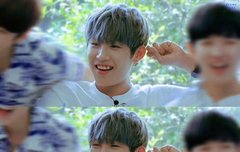 덧니 너무 소중해