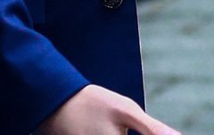 이거 누구 손이냐