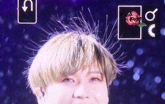 보톡스 과다 부작용 ㅋㅋㅋ