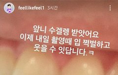 깨끗해진 숭황숭 이빨