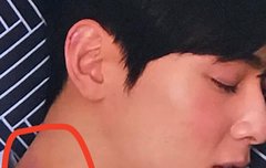 차은우 목에 멍 뭐야..?