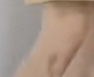 진수 다리에 이거 뭐임