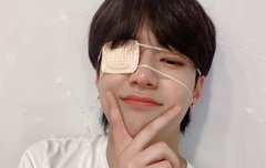 헉 건우 안대 왜 쓴거지??