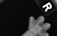 본격.. ‘NCT 127 리더 태용 엑스레이 사진 유출..’