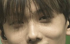 제일 어린애 피부가 이모양임?