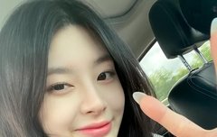 세은이 얼굴 무슨일이야