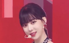 김윈터 얼굴 무슨일???