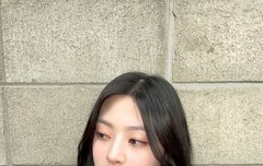 아놔 윤세은 얼굴 무슨 일