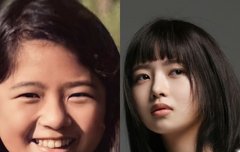 아이브레이 성형