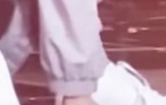 김정우 콩알주먹