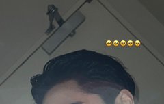 형구 다래끼 맞나봐