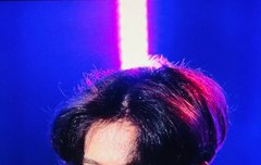 현재는 이마 까면 안될듯