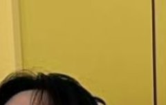 리노 손 이거 손등 맞아?