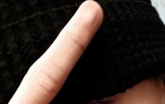 불쌍하다 루토 색입힌 게시물 지움 ㅜㅜ