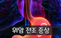 [좋은글] 위암 전조 증상