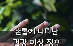 [좋은글] 손톱에 나타난 건강 이상 징후