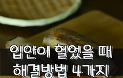 [좋은글] 입안이 헐었을 때 해결방법 4가지