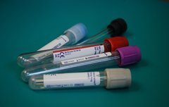 [좋은글] 혈액형의 영향력 10가지