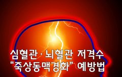 [좋은글] ◇ 심혈관·뇌혈관 저격수 죽상동맥경화 예방법