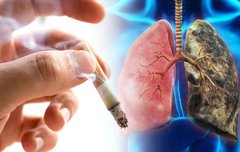 [좋은글] ◇ 흡연율이 낮은 여성의 폐암이 증가하는 이유는?