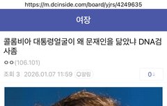 스트레스성 탈모?
