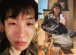 제이홉, '눈물 셀카' 공개…외조모상 비보 속 퉁퉁 부은 얼굴 [방탄소년단, 월드 와이드 '인기']