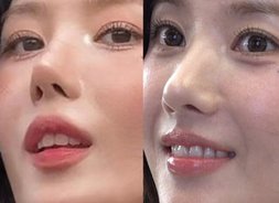 '24억 건물주' 권은비, '코 라인' 변화로 더 예뻐졌다? 날카로움→부드러운 분위기 [아이즈원, 해체 후 근황]