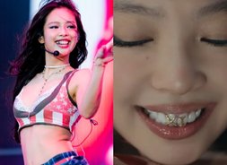  제니 치아에서 반짝이는 장미?…치아 패션 아이템 '그릴즈' 화제 [아이돌-걸그룹 우월한 DNA]
