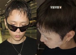 '현아♥' 용준형 '탈모설' 확산…적극 해명 나섰다 "모발 걱정 마세요" [현아, 급이 다른 섹시미→용준형과 결혼]