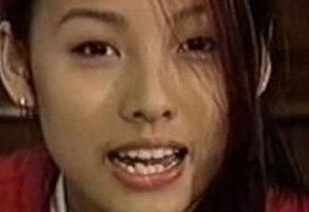 치아 교정으로 확 변신한 연예인들 | 네이트 판