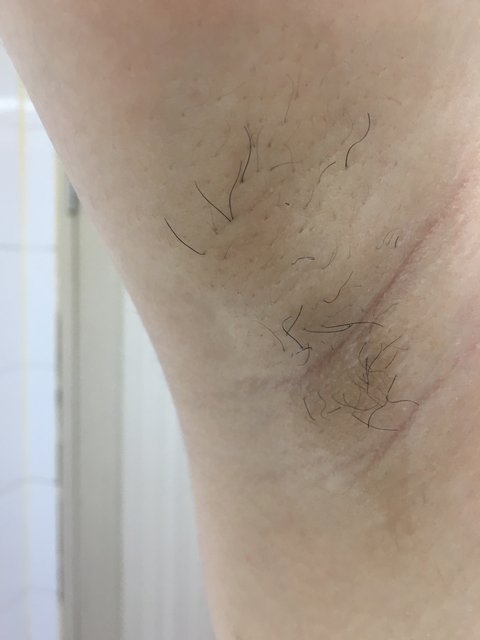 고1 여자 겨털 | 네이트 판