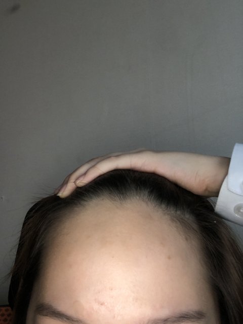  department maxim that she was jealous of people having large foreheads [teens stories] TO THE KID WHO SAID THAT SHE WAS ENVIOUS OF PEOPLE WITH WIDE FOREHEADS