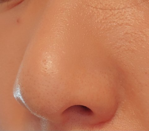 내코 복코지