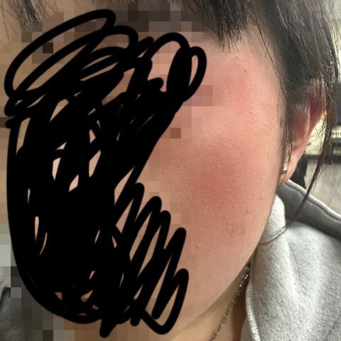 저는 폭행사건 피해자 입니다