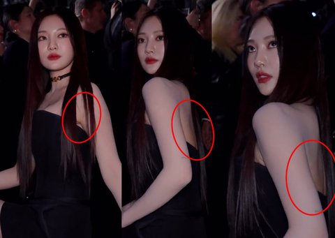 닝닝 피부가 왜그래?