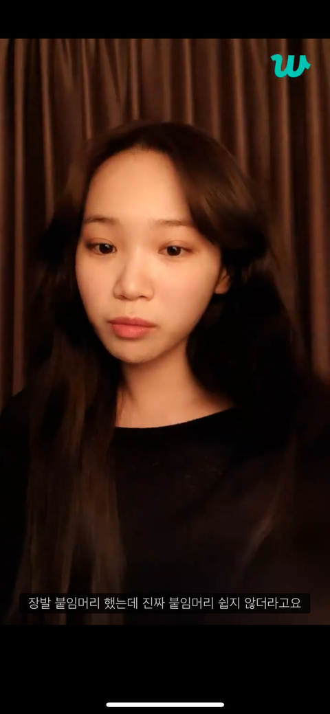 김채원 코 성형 안함