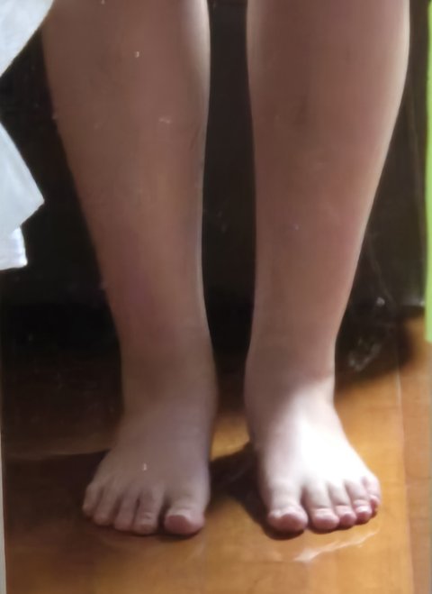 나보다 무발목인 사람 못봄..