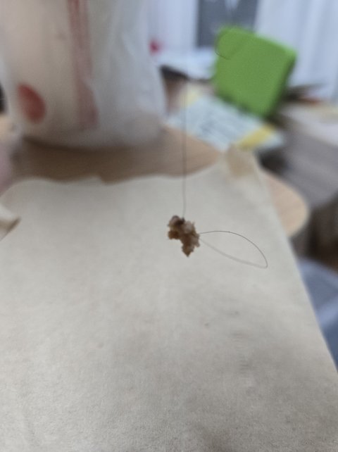 역시 믿고 먹는 버거킹, 머리카락 패티
