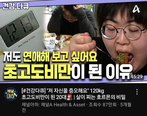 초고도비만 29살 모태솔로 여자