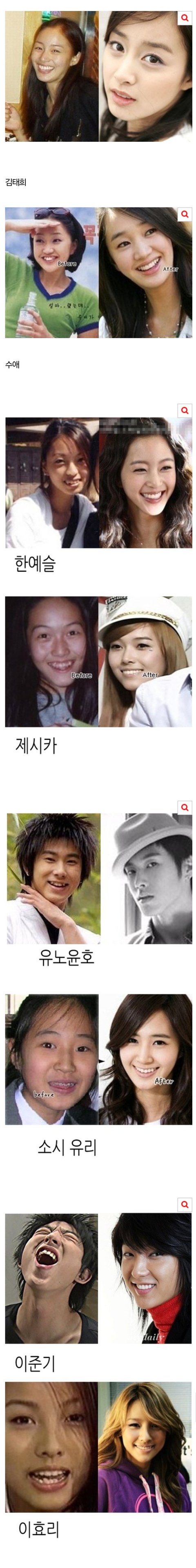 치아교정으로 다시 태어난 스타