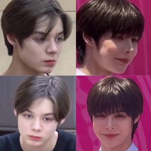 슴연생 성형 아쉽네