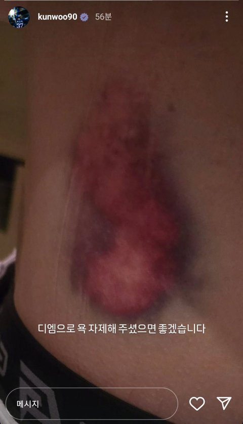 야구공 진짜 ㅈㄴ세구나