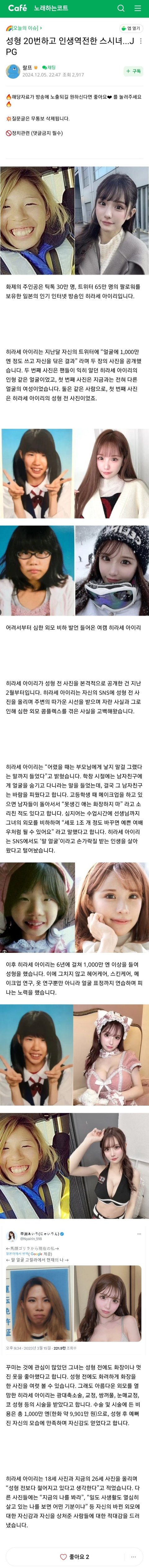 성형 20번하고 인생역전한 일본여자...JPG